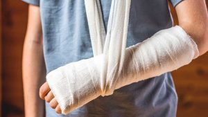 Перелом руки: первая помощь, лечение, реабилитация