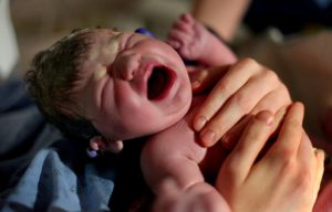 Болевой синдром вызывает у младенца безостановочный плач